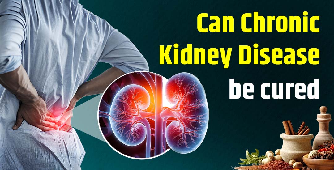 Can Chronic Kidney Disease Be Cured? Can Chronic Kidney Disease Be Cured?
